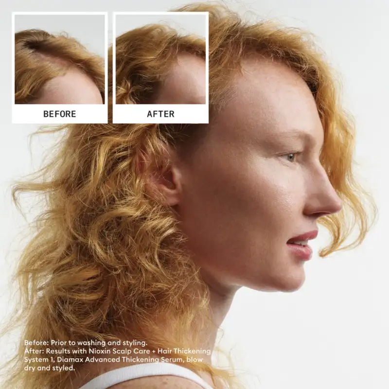 nioxin-scalp-hair-thickening-system-1-trial-kit--4