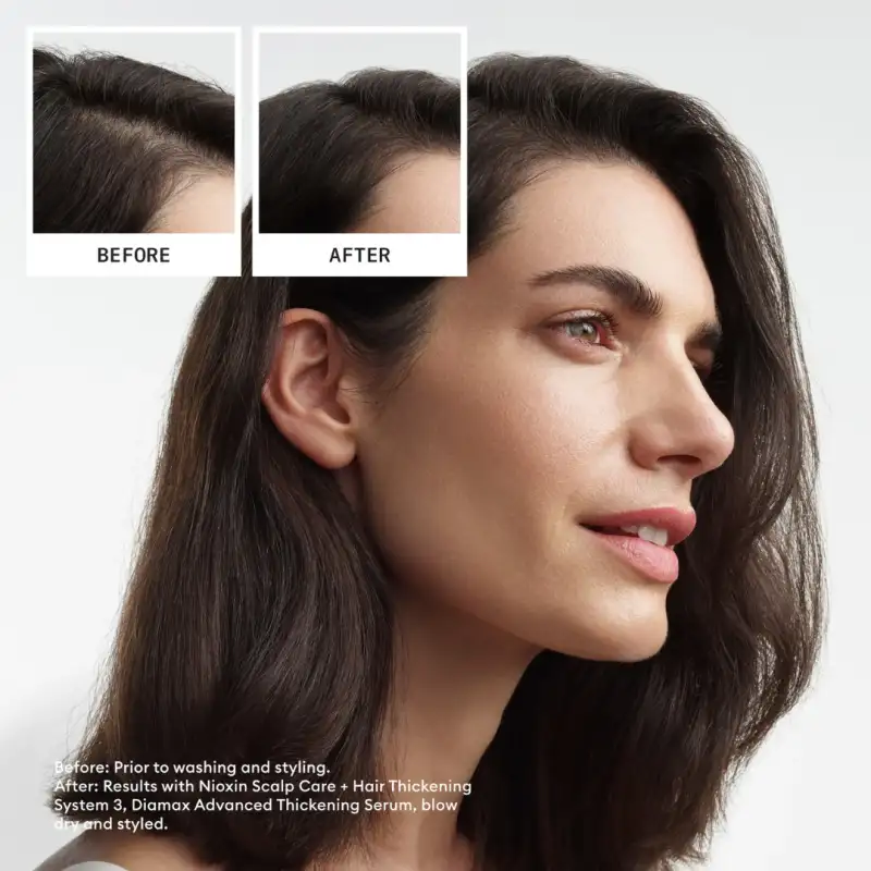nioxin-scalp-hair-thickening-system-3-trial-kit--4