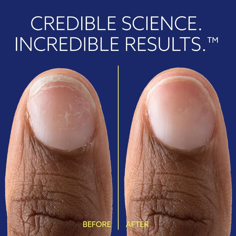 epres-ephd-bond-repair-nail-treatment--3