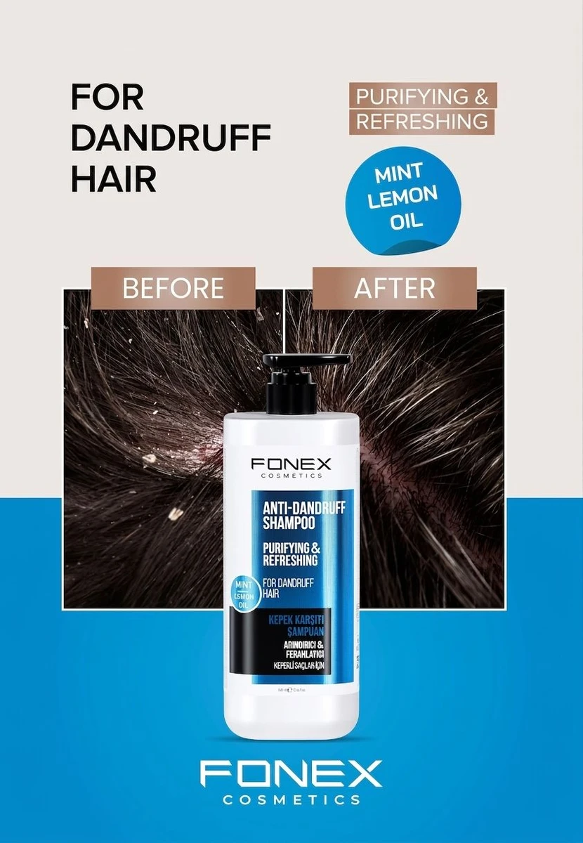 fonex-anti-dandruff-shampoo-900ml--1