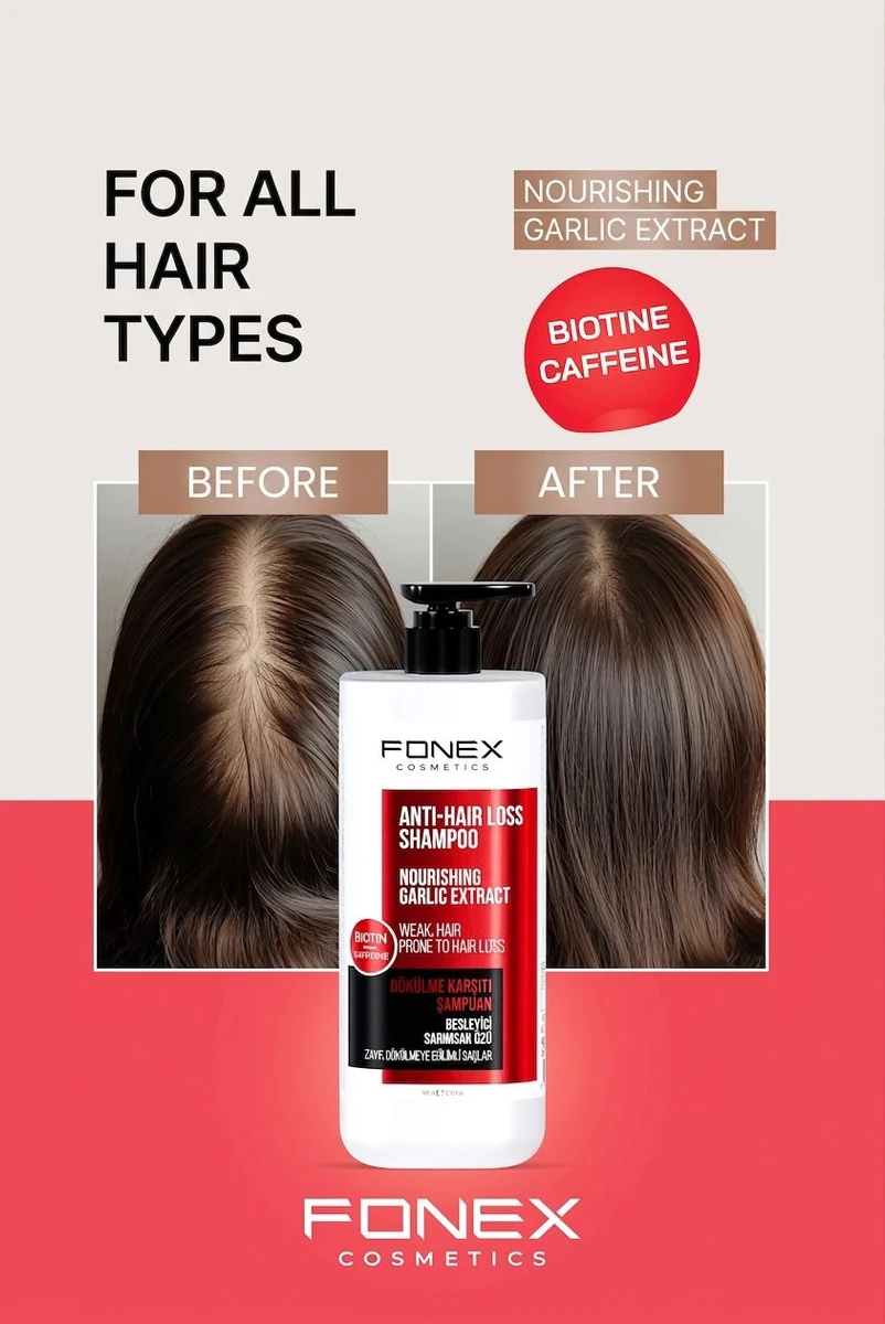 fonex-anti-hair-loss-shampoo--1