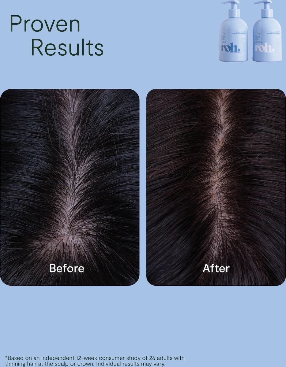 nak-roh-reset-scalp-duo--2