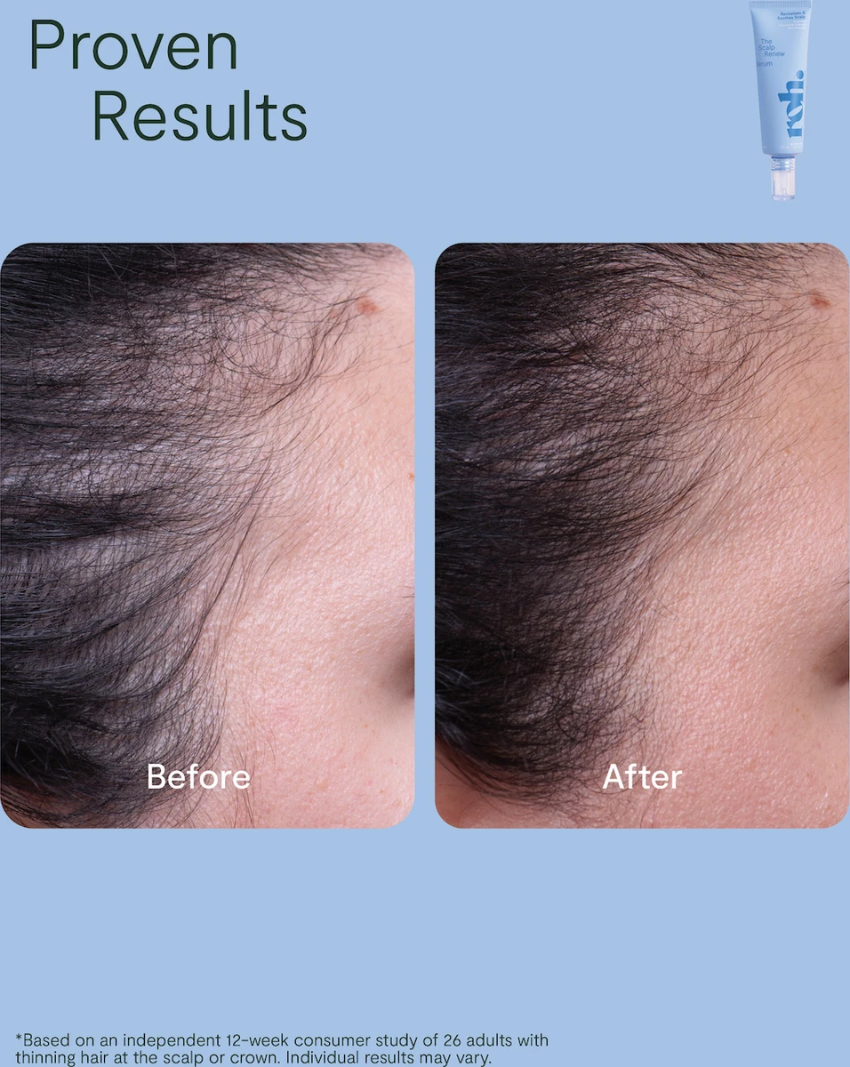 nak-roh-reset-scalp-duo--3